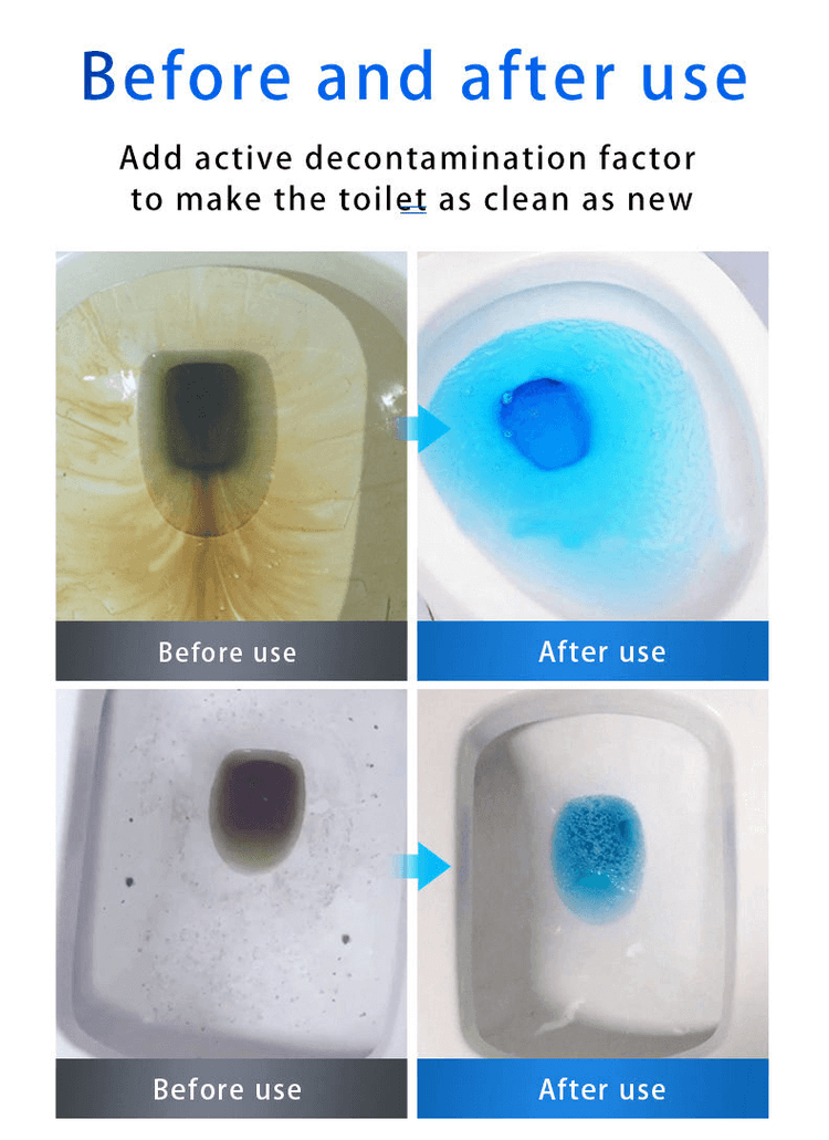 🔥HOT SALE BUY 1 GET 1 FREE🔥 SINK & DRAIN CLEANER