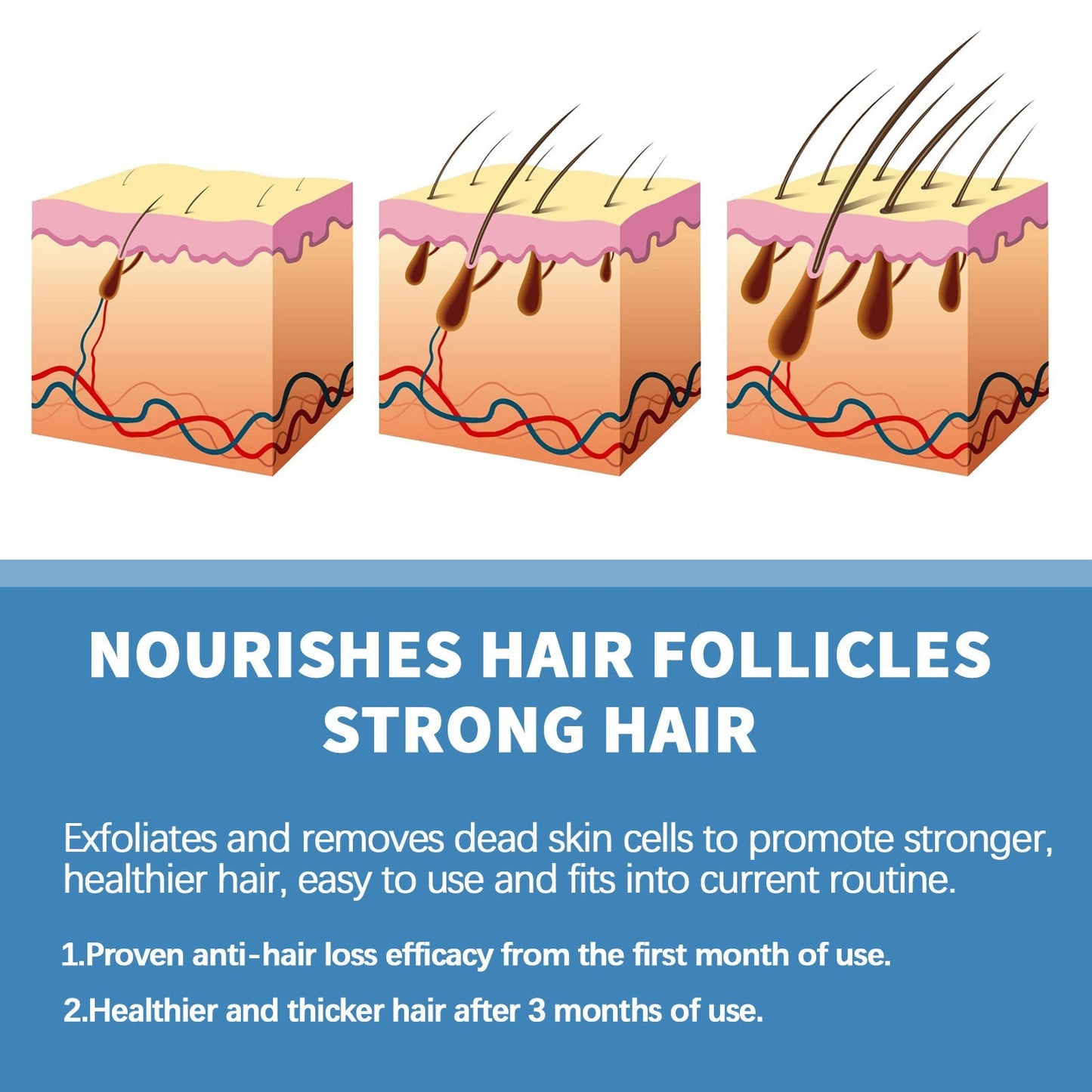 🌿EAST MOON Minoxi Roll-On Hair Treatment