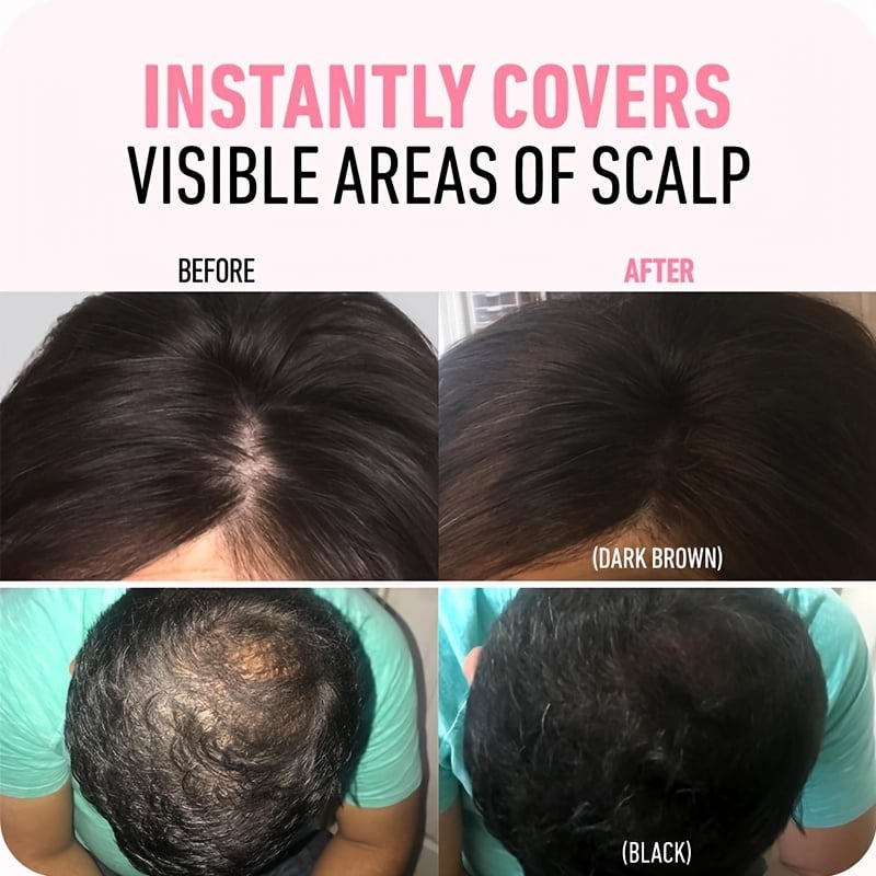 Hairline Powder  (fit all hair color)🌈