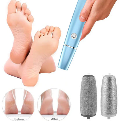 🌸Mother's Day Hot Sale 75%🌸Electric Feet Callus Remover