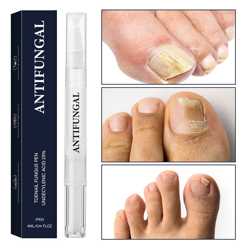 ✨New product launch🔥Toenail fungus treatment pen for damaged nails