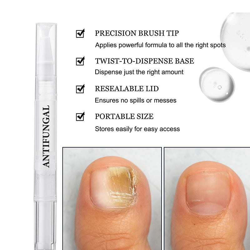 ✨New product launch🔥Toenail fungus treatment pen for damaged nails