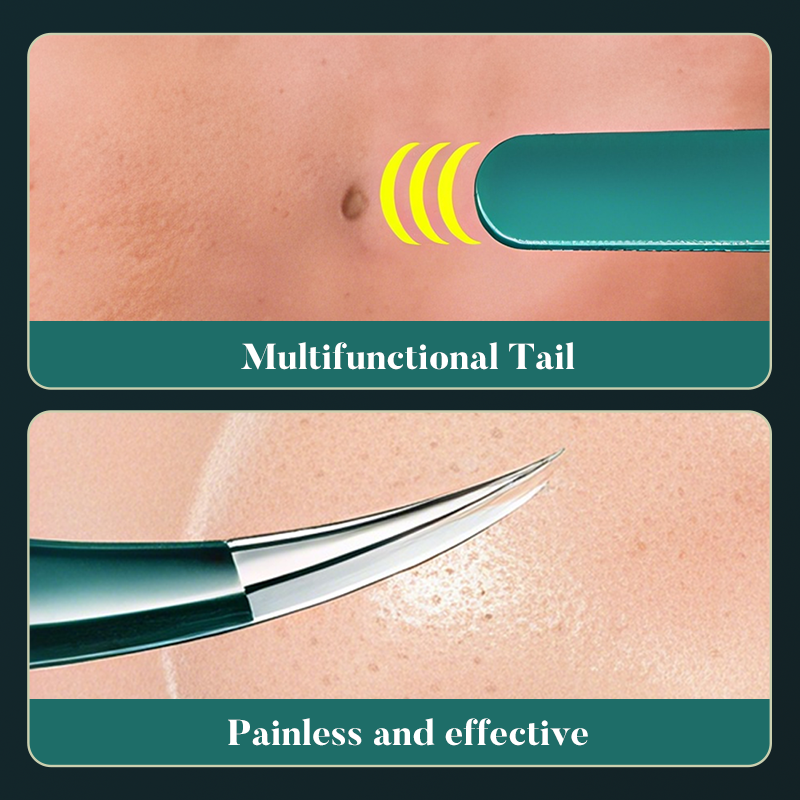 Professional Stainless Steel Facial Blackhead Tweezers